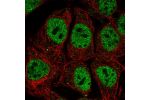 Immunofluorescent staining of human cell line CACO-2 shows localization to nucleoplasm & vesicles.