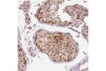 Immunohistochemical staining of human testis shows moderate nuclear and cytoplasmic positivity in cells in seminiferous ducts, Leydig cells.
