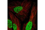 Immunofluorescent staining of human cell line HeLa shows localization to nucleoplasm.