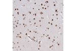 Immunohistochemical staining of human cerebral cortex shows strong nuclear positivity in neurons.