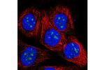 Immunofluorescent staining of human cell line HaCaT shows localization to nucleoli.