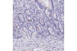 Immunohistochemical staining of human duodenum shows strong cytoplasmic positivity in neuroendocrine cells.