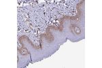Immunohistochemical staining of human uterus, post-menopause shows strong membranous positivity in glandular cells.