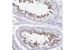 Immunohistochemical staining of human testis shows strong cytoplasmic positivity in subset of cells in seminiferous ducts.
