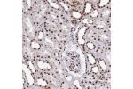 Immunohistochemical staining of human kidney shows strong nuclear positivity in cells in renal tubules and cells in glomeruli.