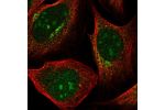 Immunofluorescent staining of human cell line U-2 OS shows localization to nucleus, nucleoli & mitochondria.
