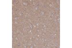 Immunohistochemical staining of human cerebral cortex shows moderate cytoplasmic positivity in neuropil.