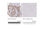 Immunohistochemistry analysis in human duodenum and cerebral cortex tissues using HPA059146 antibody. Corresponding PDX1 RNA-seq data are presented for the same tissues.