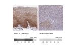 Immunohistochemistry analysis in human esophagus and pancreas tissues using Anti-WNK1 antibody. Corresponding WNK1 RNA-seq data are presented for the same tissues.