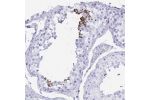 Immunohistochemical staining of human testis shows moderate cytoplasmic positivity in spermatozoa.