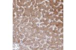 Immunohistochemical staining of human liver shows moderate cytoplasmic positivity in hepatocytes.