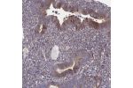 Immunohistochemical staining of human endometrium shows moderate cytoplasmic positivity in glandular cells.