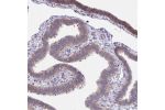 Immunohistochemical staining of human fallopian tube shows moderate cytoplasmic positivity in glandular cells.