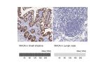 Immunohistochemistry analysis in human small intestine and lymph node tissues using HPA059299 antibody. Corresponding MAOA RNA-seq data are presented for the same tissues.