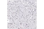 Immunohistochemical staining of human hypothalamus shows nuclear positivity in neurons.