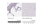 Immunohistochemical staining of human lung shows strong cytoplasmic positivity in macrophages.