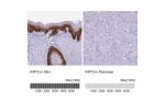 Immunohistochemistry analysis in human skin and pancreas tissues using HPA059479 antibody. Corresponding KRT5 RNA-seq data are presented for the same tissues.