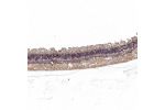 Immunohistochemical staining of human eye, retina shows moderate positivity in photoreceptor cells and nerve fibers.