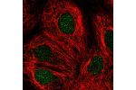 Immunofluorescent staining of human cell line MCF7 shows localization to nucleus.