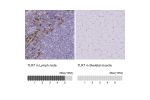 Immunohistochemistry analysis in human lymph node and skeletal muscle tissues using HPA059613 antibody. Corresponding TLR7 RNA-seq data are presented for the same tissues.