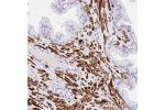 Immunohistochemical staining of human smooth muscle shows strong cytoplasmic positivity in smooth muscle cells.