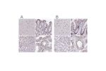 Immunohistochemistry analysis in human testis and pancreas tissues using Anti-PUF60 antibody. Corresponding PUF60 RNA-seq data are presented for the same tissues.