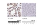 Immunohistochemistry analysis in human testis and liver tissues using HPA059729 antibody. Corresponding HN1 RNA-seq data are presented for the same tissues.