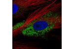 Immunofluorescent staining of human cell line BJ shows localization to endoplasmic reticulum.