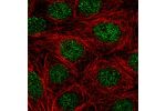 Immunofluorescent staining of human cell line MCF7 shows localization to nucleoplasm.