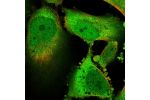 Immunofluorescent staining of human cell line U-251 MG shows localization to nucleoplasm, plasma membrane & cytosol.