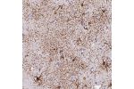 Immunohistochemical staining of human caudate shows strong cytoplasmic and membranous positivity in astrocytes.