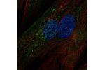 Immunofluorescent staining of human cell line BJ shows localization to nuclear bodies, the Golgi apparatus & vesicles.