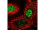 Immunofluorescent staining of human cell line A-431 shows localization to nucleoplasm.
