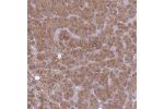 Immunohistochemical staining of human adrenal gland shows moderate cytoplasmic positivity in glandular cells.