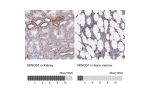 Immunohistochemistry analysis in human thyroid gland and pancreas tissues using Anti-MINOS1 antibody. Corresponding MINOS1 RNA-seq data are presented for the same tissues.