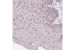 Immunohistochemical staining of human skin shows moderate nuclear positivity in squamous epithelial cells.
