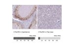 Immunohistochemistry analysis in human epididymis and pancreas tissues using HPA059965 antibody. Corresponding C19orf43 RNA-seq data are presented for the same tissues.