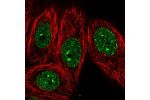 Immunofluorescent staining of human cell line MCF7 shows localization to nucleoplasm & nuclear bodies.