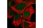 Immunofluorescent staining of human cell line HEK 293 shows localization to nucleoplasm & cell junctions.