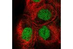 Immunofluorescent staining of human cell line A-431 shows localization to nucleoplasm.