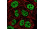 Immunofluorescent staining of human cell line RT4 shows localization to nucleoplasm.