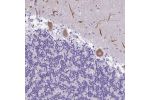 Immunohistochemical staining of human cerebellum shows moderate cytoplasmic positivity in Purkinje cells.