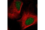 Immunofluorescent staining of human cell line U-2 OS shows localization to nucleoplasm.