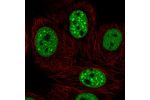 Immunofluorescent staining of human cell line MCF7 shows localization to nucleoplasm & nuclear speckles.