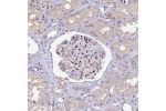 Immunohistochemical staining of human kidney shows moderate cytoplasmic positivity in cells in glomeruli.