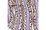 Immunohistochemical staining of human rectum shows moderate cytoplasmic positivity in glandular cells.