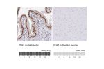 Immunohistochemistry analysis in human gallbladder and skeletal muscle tissues using HPA060318 antibody. Corresponding PLK3 RNA-seq data are presented for the same tissues.