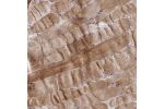 Immunohistochemical staining of human skeletal muscle shows strong cytoplasmic positivity in myocytes.