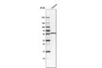 Western blot analysis in human plasma.