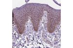 Immunohistochemical staining of human skin shows moderate nuclear positivity in squamous epithelial cells.